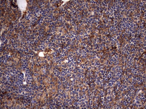 KRT7 / CK7 / Cytokeratin 7 Antibody (clone OTI2A2)
