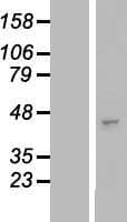 B3GNT3 / TMEM3 Protein (Over-Expression Lysate Myc-DDK (Flag))