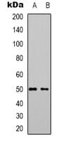 ZFP36L2 Antibody (Internal)