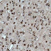 CACNG3 Antibody