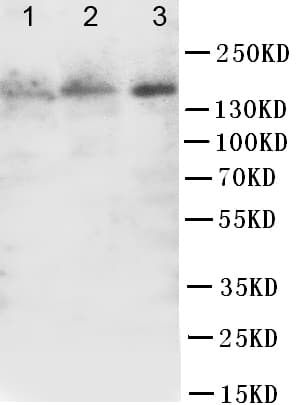FLT1 / VEGFR1 Antibody (aa1299-1317)