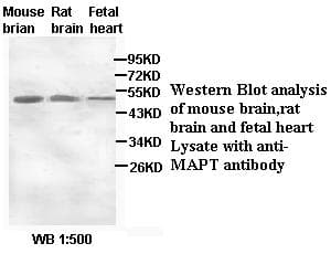Polyclonal Rabbit anti-Human MAPT / Tau Antibody (IHC, WB)