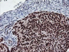 TP53 / p53 Antibody (clone OTI2H6, Carrier-free)