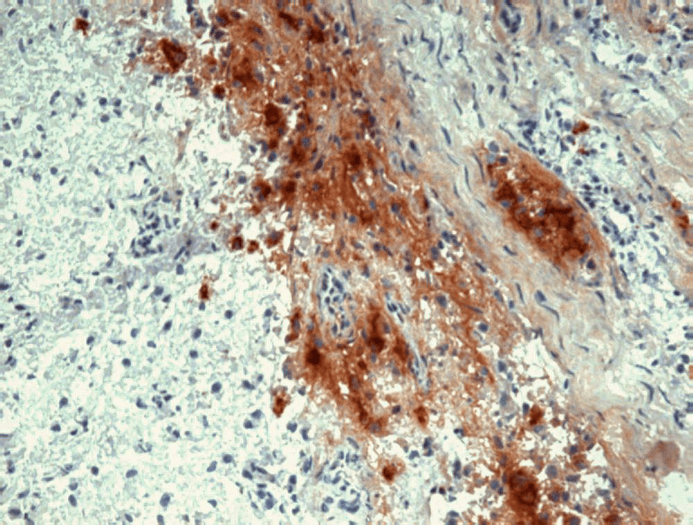 Beta Endorphin Antibody (clone B31.15)