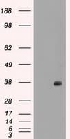 FCGR2 / CD32 Antibody (clone OTI16D6)