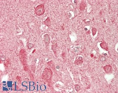 IHC-plus™ Polyclonal Rabbit anti-Human MAP1LC3 Antibody (IHC, WB)