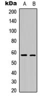 TH / Tyrosine Hydroxylase Antibody (phospho-Ser19)