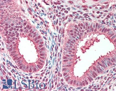 IHC-plus™ Polyclonal Rabbit anti-Human TPI1 / TPI Antibody (aa199-249, IHC, WB)