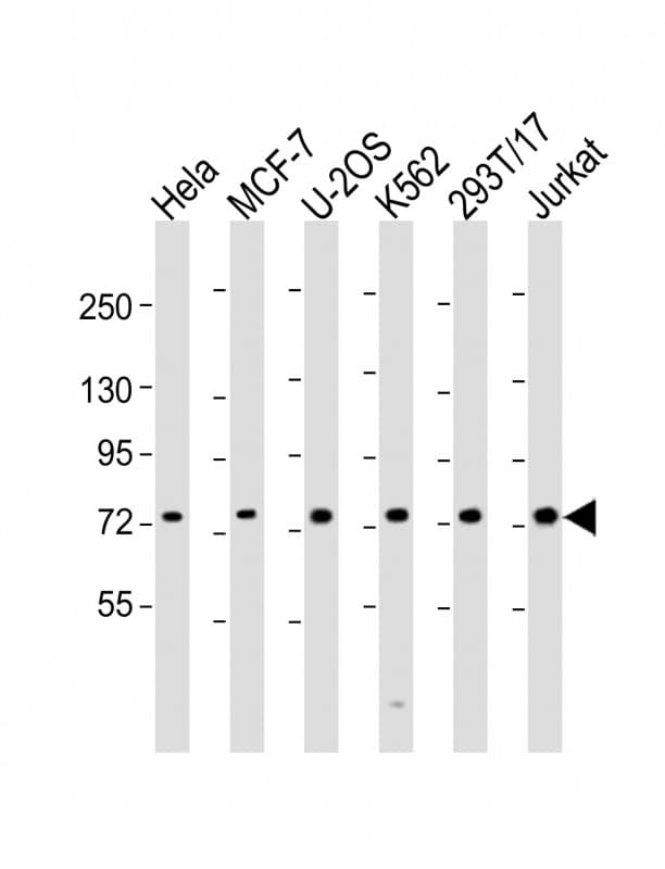 HEC1 / NDC80 Antibody (aa594-628)