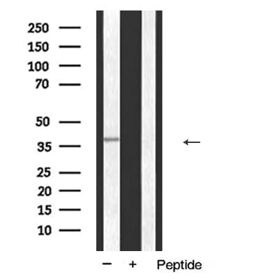 ANXA1 / Annexin A1 Antibody