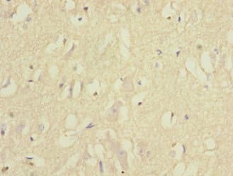 EPHB1 / EPH Receptor B1 Antibody