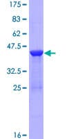 Human RBP2 / CRBPII Protein (Recombinant GST)