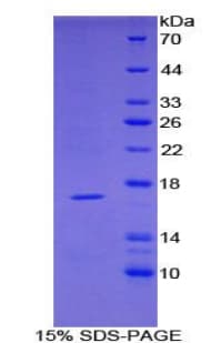 Mouse TNFRSF19L / RELT Protein (Recombinant His)