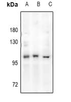 AR / Androgen Receptor Antibody