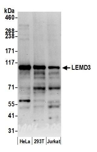 Polyclonal Rabbit anti-Human LEMD3 / MAN1 Antibody (aa300-350, WB)
