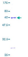 Human GIMAP5 Protein (Recombinant GST)