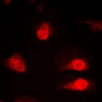 SYNCRIP / HnRNP Q Antibody (Internal)