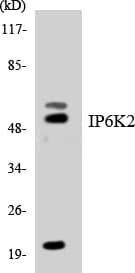 Polyclonal Rabbit anti-Human IP6K2 Antibody (aa139-188, WB)