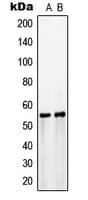 Polyclonal Rabbit anti-Human SLC2A3 / GLUT3 Antibody (C-Terminus, WB)