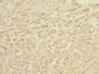 C1orf127 Antibody