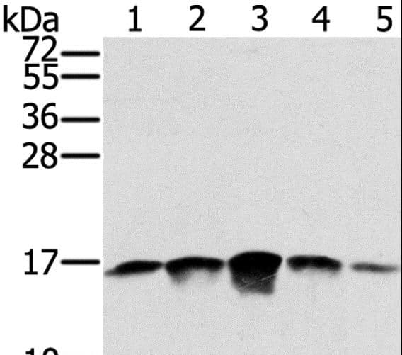 Polyclonal Rabbit anti-Human SSBP1 / mtSSB Antibody (IHC, WB)