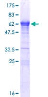 Human LCORL Protein (Recombinant GST)