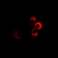 Polyclonal Rabbit anti-Human CPT2 Antibody (IHC, IF, WB)
