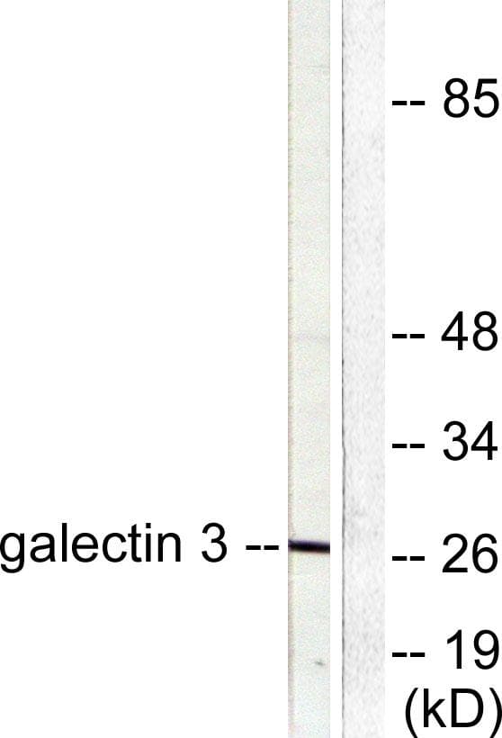 LGALS3 / Galectin 3 Antibody