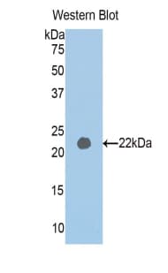 PAPPA2 / Pappalysin 2 Antibody (aa1309-1492)