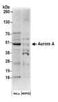 AURKA / Aurora-A Antibody