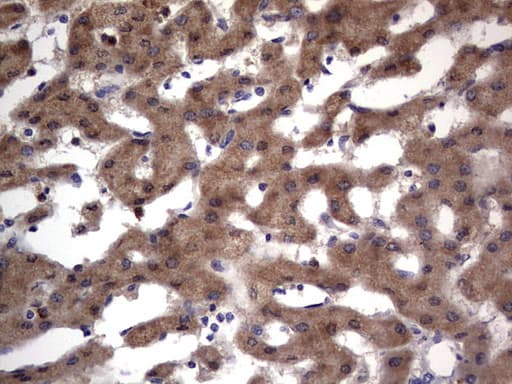 PRX-1 / PRRX1 Antibody (clone OTI1E10)