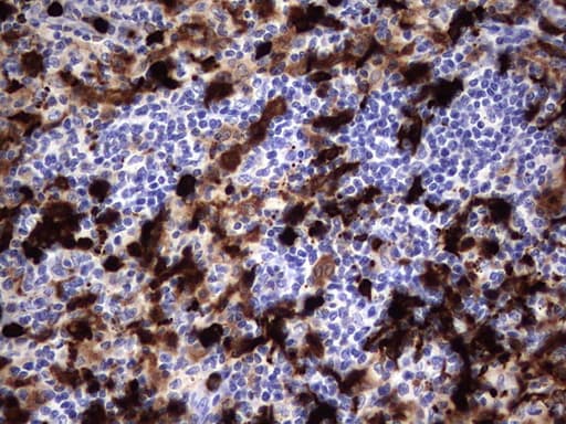 S100A9 / MRP14 Antibody (clone OTI8C2)