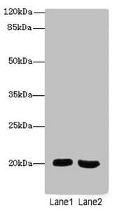 MSRB2 / MSRB Antibody