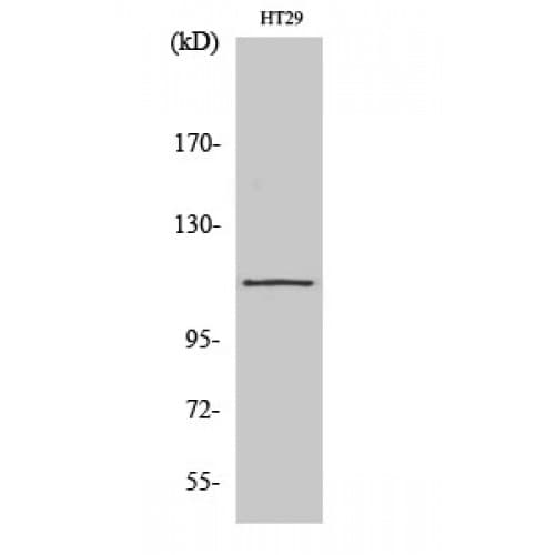 Polyclonal Rabbit anti-Human ATP2A1 / SERCA1 Antibody (520-600 aa, Internal, IHC, WB)