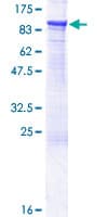 Human CLLP / CTNNAL1 Protein (Recombinant GST)