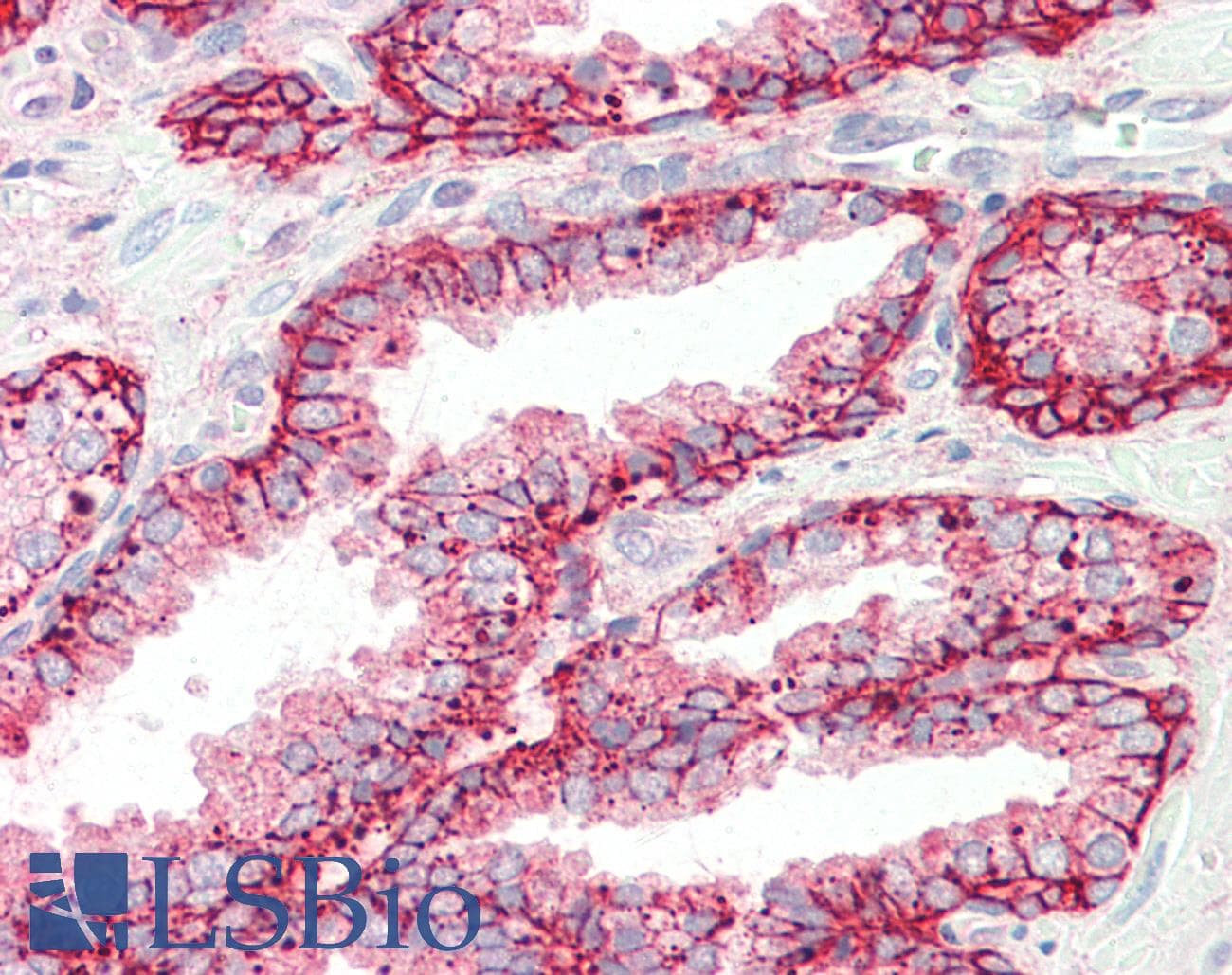 IHC-plus™ CCK4 / PTK7 Antibody (aa31-199, clone 4F9)