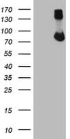 FBXO21 Antibody (clone OTI6C10)
