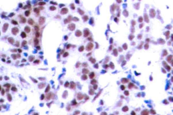 JUNB / JUN-B Antibody (phospho-Ser259)