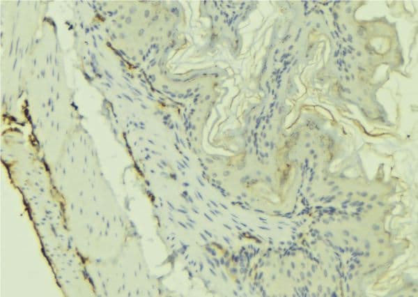 CX3CL1 / Fractalkine Antibody