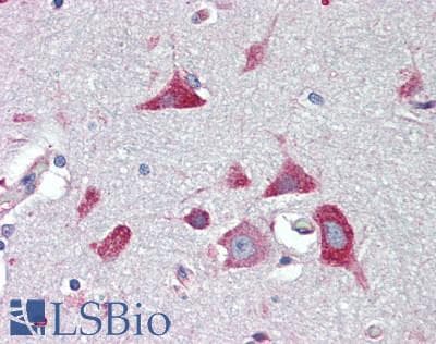 IHC-plus™ NACA Antibody