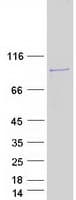 Human FAM160B2 / RAI16 Protein (Recombinant Myc-DDK (Flag))