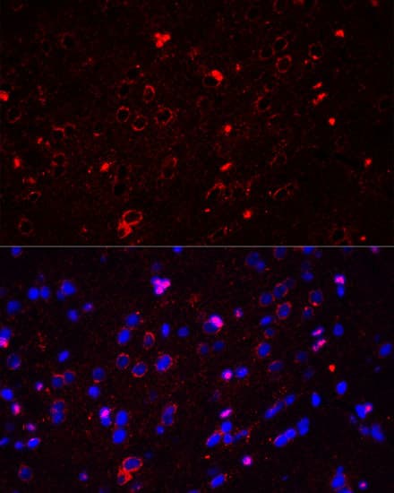 GRIN2A / NMDAR2A / NR2A Antibody