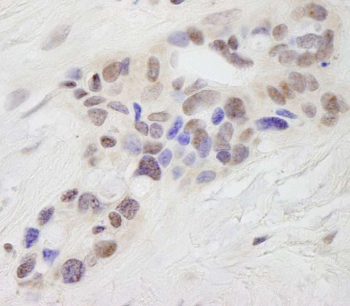 STAT6 Antibody (aa600-650)