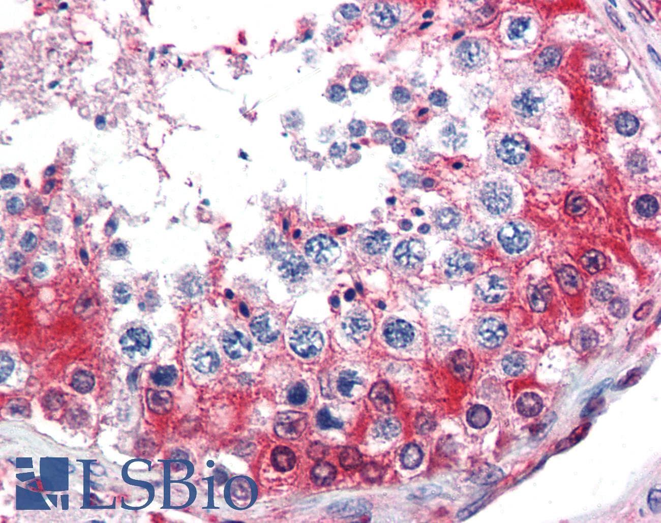 IHC-plus™ Polyclonal Rabbit anti-Human GAPDH Antibody (aa73-87, IHC, WB)