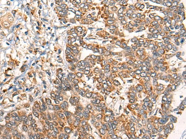 Polyclonal Rabbit anti-Human EPHA6 / EPH Receptor A6 Antibody (IHC, WB)