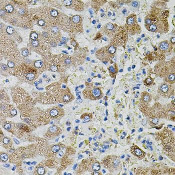 TGFA / TGF Alpha Antibody