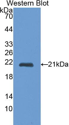 CTSL / Cathepsin L Antibody (aa114-288)