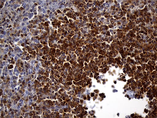 Monoclonal Mouse anti-Human SH3BP1 Antibody (clone OTI2C7, IHC, WB)