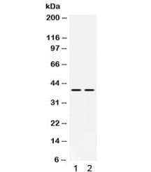 Polyclonal Rabbit anti-Human MAP2K3 / MEK3 / MKK3 Antibody (IHC, WB)