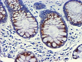 GOLM1 / GP73 / GOLPH2 Antibody (clone OTI5F4)